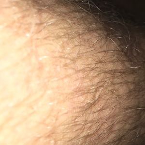 My leg hair